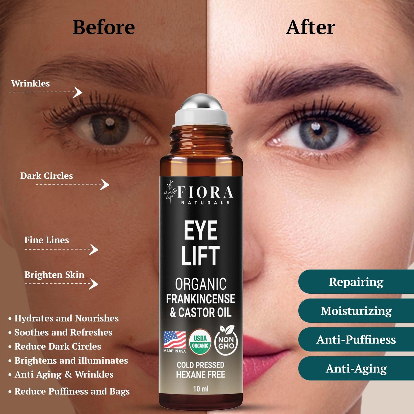Tea Tree Oil – 100% Pure Organic Tea Tree Essential Oil for Skin, Face, Hair, Scalp, Nails, and Toenail – Therapeutic Grade Tree Tea Oil for Acne & Hair Growth – 1 fl oz - by Fiora Naturals